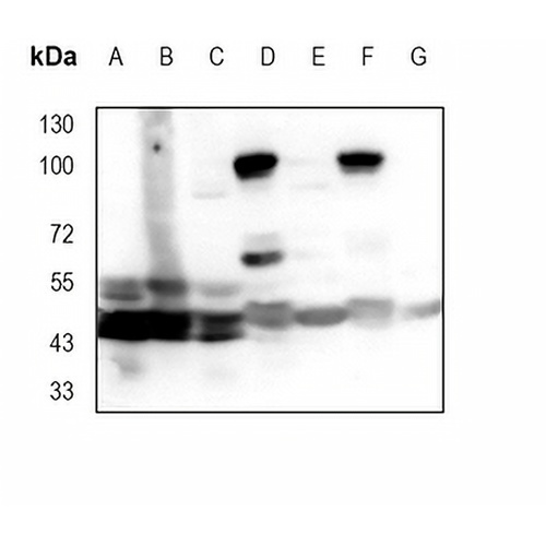 JNK1/3 Rabbit Monoclonal Antibody(C1771)