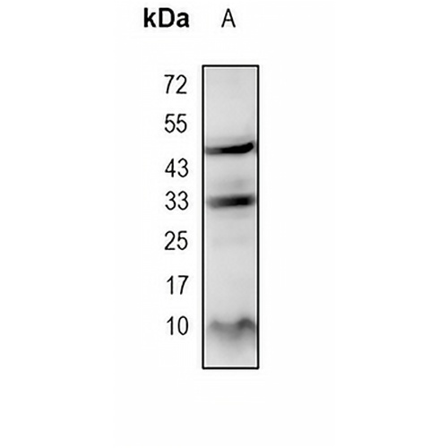 IGF2 Rabbit Monoclonal Antibody(C1772)
