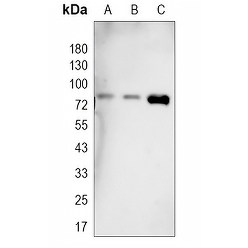 RIPK1 Rabbit Monoclonal Antibody(C1773)