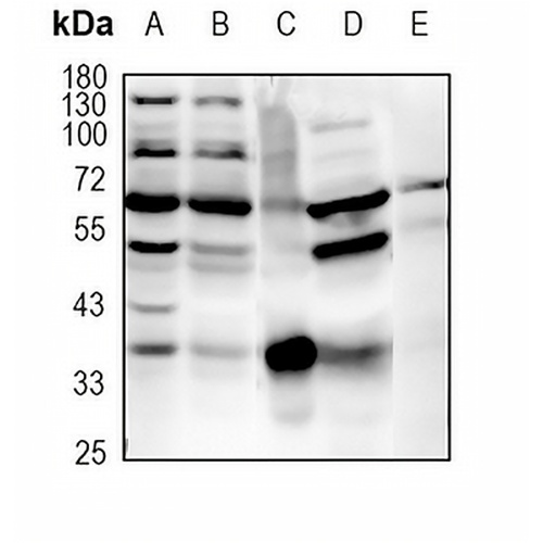 c-FOS Rabbit Monoclonal Antibody(C1775)