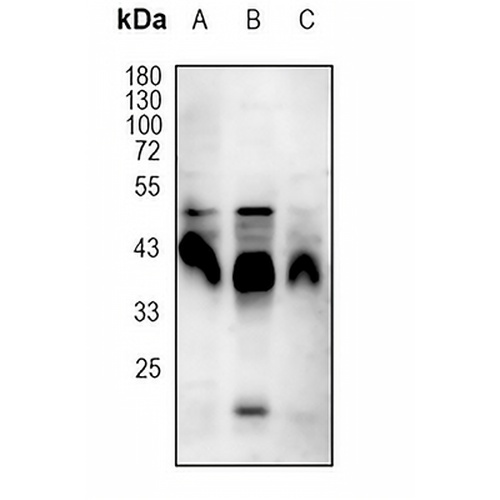 CD95 Rabbit Monoclonal Antibody(C1777)