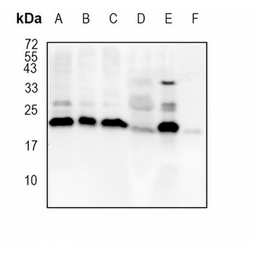 Peroxiredoxin 1 Rabbit Monoclonal Antibody(C1778)
