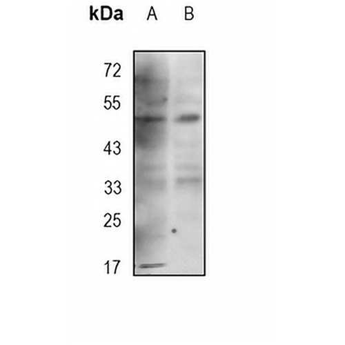 NHERF1 Rabbit Monoclonal Antibody(C1779)