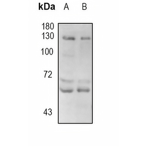 ABL2 Rabbit Monoclonal Antibody(C1780)
