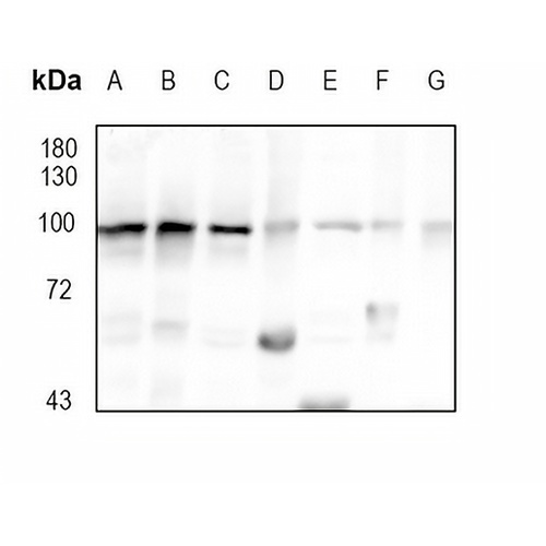 Glucocorticoid Receptor Rabbit Monoclonal Antibody(C1781)