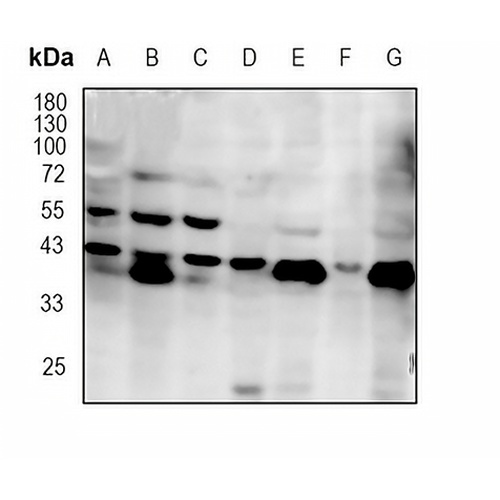 Laminin Receptor Rabbit Monoclonal Antibody(C1783)
