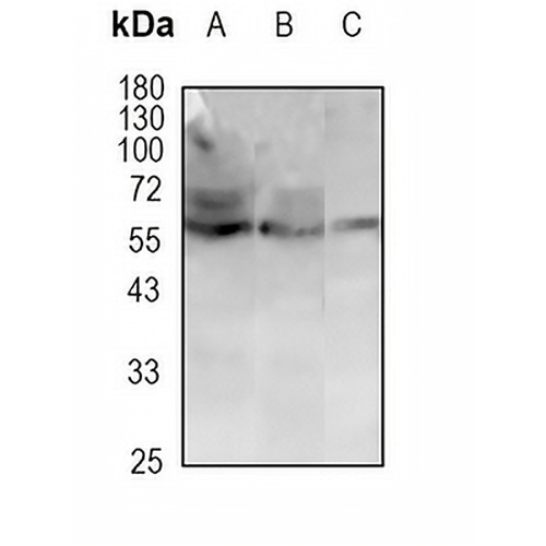 PDIA2 Rabbit Monoclonal Antibody(C1785)