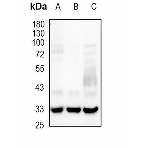 LYVE-1 Rabbit Monoclonal Antibody(C1786)