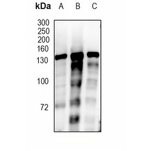 BCL11B Rabbit Monoclonal Antibody(C1787)