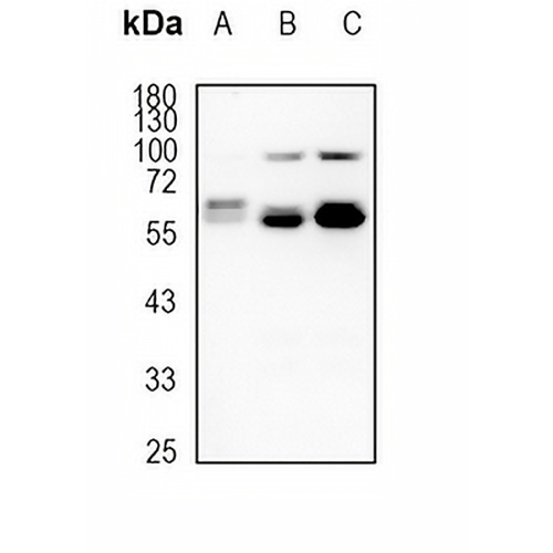 FTCD Rabbit Monoclonal Antibody(C1788)