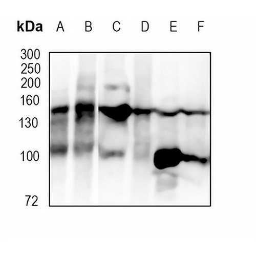 53BP2 Rabbit Monoclonal Antibody(C1789)