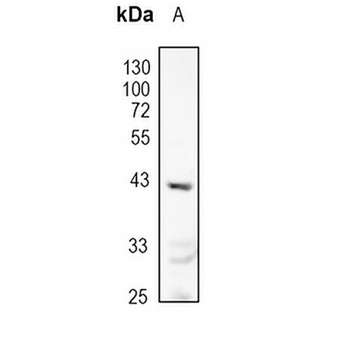 AT1 Rabbit Monoclonal Antibody(C1791)