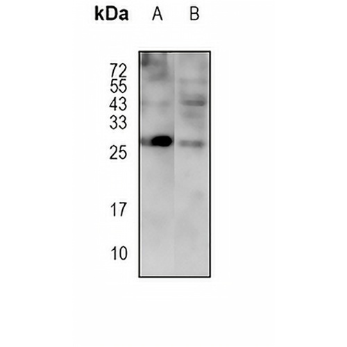 GADD153 Rabbit Monoclonal Antibody(C1792)