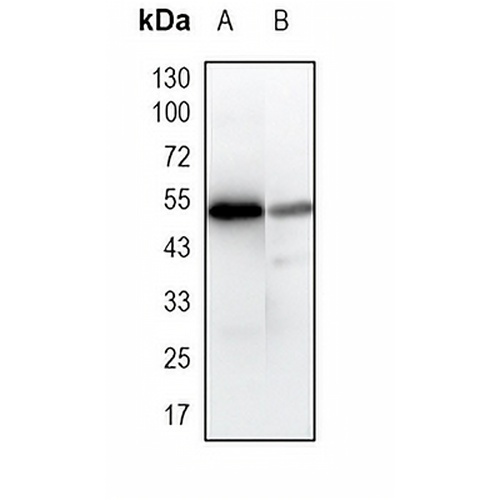 Gc-globulin Rabbit Monoclonal Antibody(C1793)