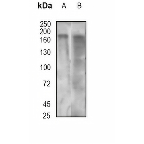 CD66e Rabbit Monoclonal Antibody(C1794)