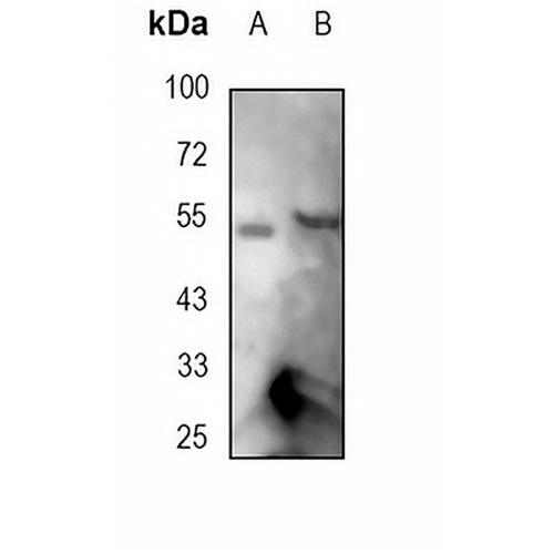 FOXA2 Rabbit Monoclonal Antibody(C1795)