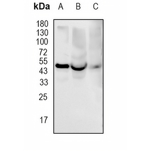 Dopamine Transporter Rabbit Monoclonal Antibody(C1798)
