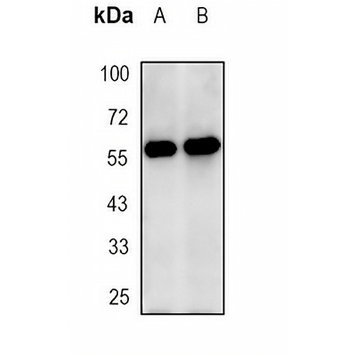 GRP58 Rabbit Monoclonal Antibody(C1800)