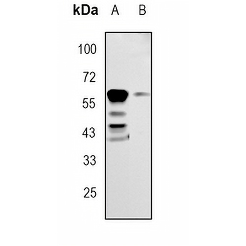 RPE65 Rabbit Monoclonal Antibody(C1801)