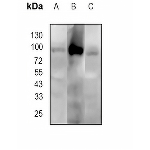 FAP alpha Rabbit Monoclonal Antibody(C1802)