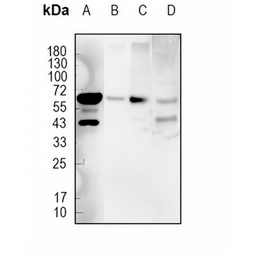 EAAT2 Rabbit Monoclonal Antibody(C1804)