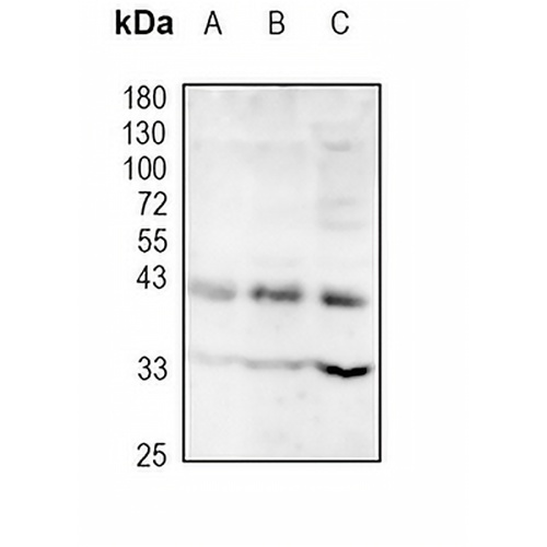 Wnt-5a Rabbit Monoclonal Antibody(C1805)