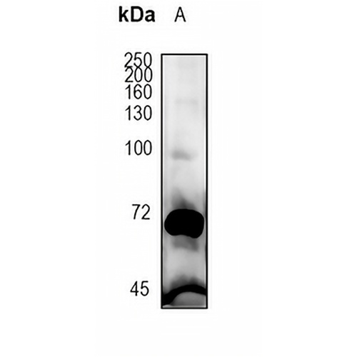 PCSK9 Rabbit Monoclonal Antibody(C1806)