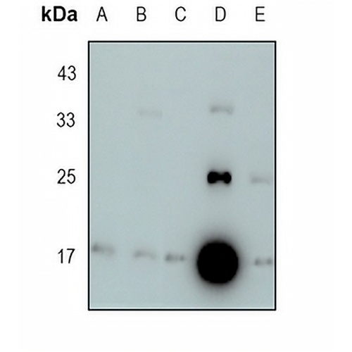 LMO2 Rabbit Monoclonal Antibody(C1807)