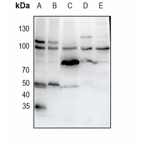 Golgin-97 Rabbit Monoclonal Antibody(C1808)