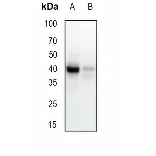 PON1 Rabbit Monoclonal Antibody(C1809)