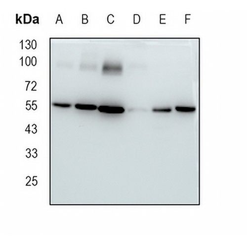 Glutathione Reductase Rabbit Monoclonal Antibody(C1811)