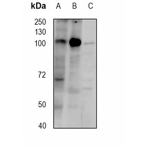 DDX58 Rabbit Monoclonal Antibody(C1812)