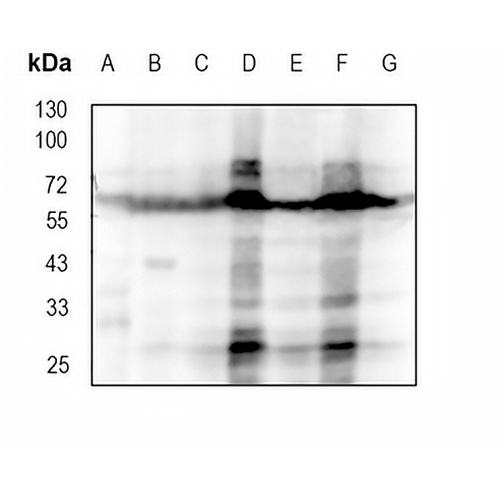 CRMP2 Rabbit Monoclonal Antibody(C1813)