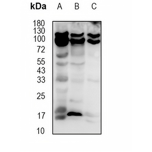 Cholinesterase Rabbit Monoclonal Antibody(C1814)
