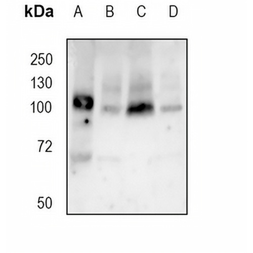 Apolipoprotein E Receptor 2 Rabbit Monoclonal Antibody(C1815)