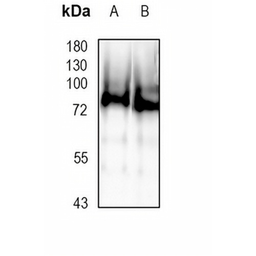 DNAI1 Rabbit Monoclonal Antibody(C1816)
