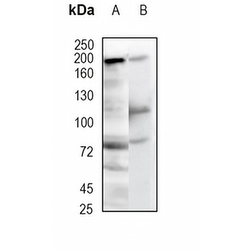 Complement C4-A Rabbit Monoclonal Antibody(C1819)