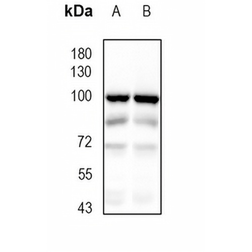 Dynamin 1 Rabbit Monoclonal Antibody(C1820)