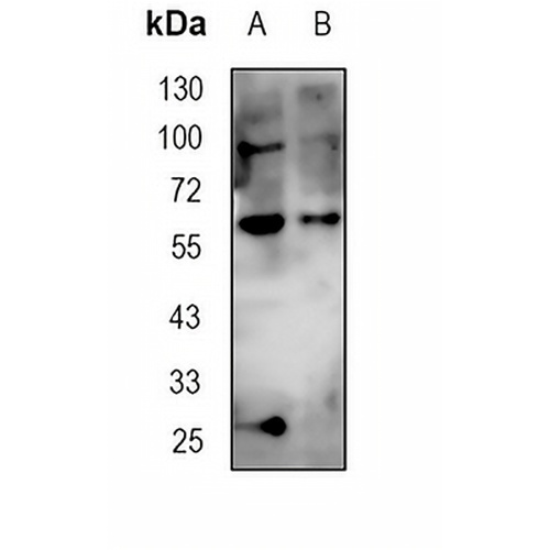 Clusterin Rabbit Monoclonal Antibody(C1822)