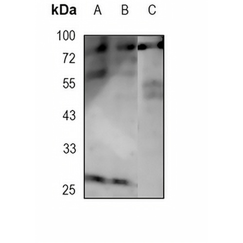 PKC eta Rabbit Monoclonal Antibody(C1823)