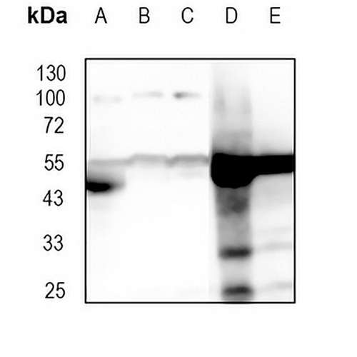 Cytochrome P450 2D6 Rabbit Monoclonal Antibody(C1824)