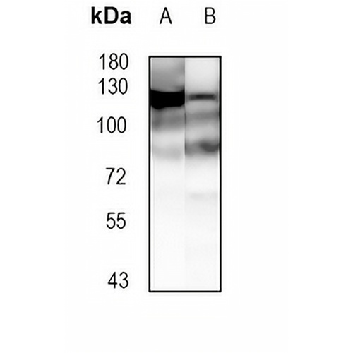NF-kappaB p100 Rabbit Monoclonal Antibody(C1828)