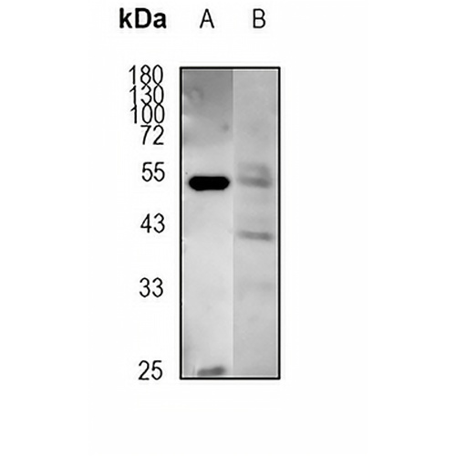 Factor IX Rabbit Monoclonal Antibody(C1829)