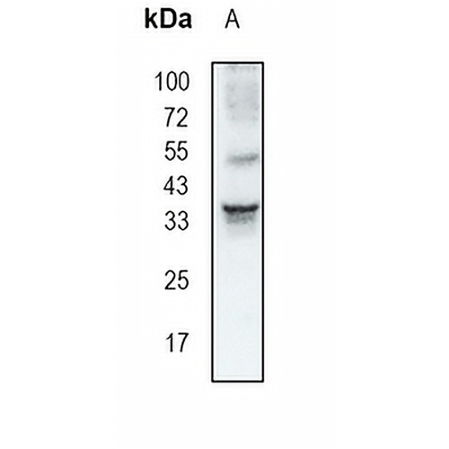 BOB1 Rabbit Monoclonal Antibody(C1830)