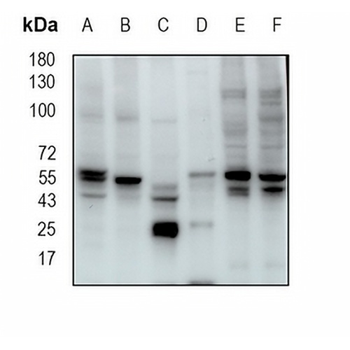 ATG12 Rabbit Monoclonal Antibody(C1831)