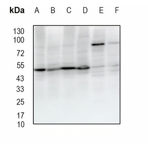 Pr-Set7 Rabbit Monoclonal Antibody(C1834)