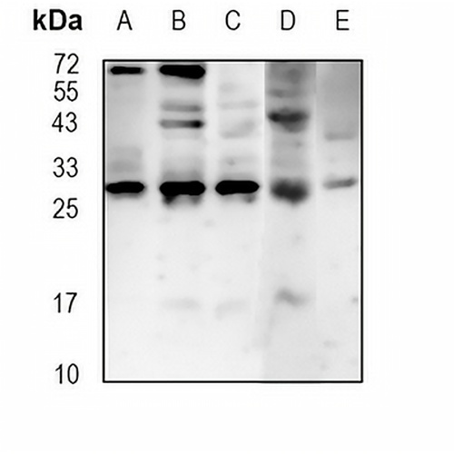 CBX7 Rabbit Monoclonal Antibody(C1835)