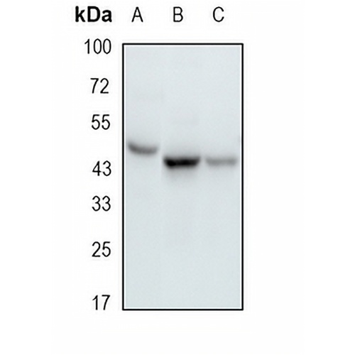 RRM2 Rabbit Monoclonal Antibody(C1840)