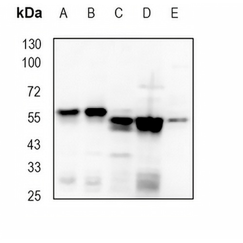 Importin alpha 2 Rabbit Monoclonal Antibody(C1841)