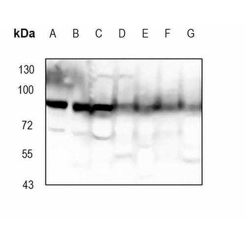 CD110 Rabbit Monoclonal Antibody(C1842)